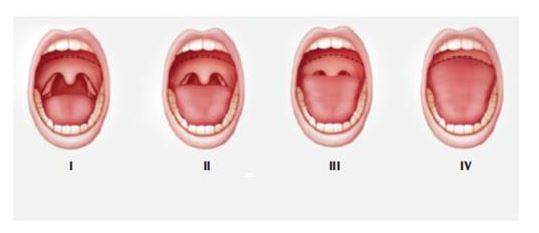 Ngủ ngáy chẳng phải chuyện đùa - Phòng khám kỹ thuật cao Phoenix