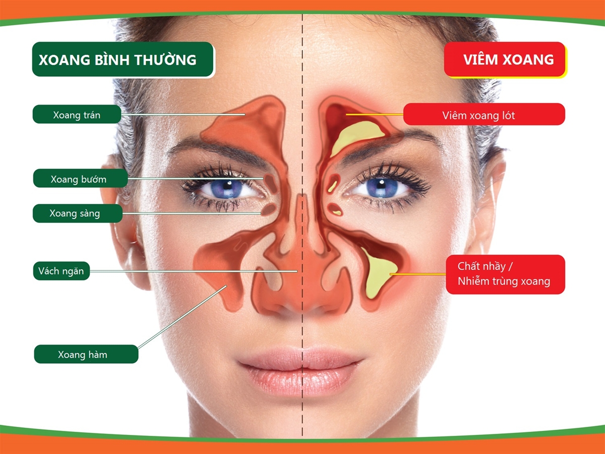 BỆNH TAI MŨI HỌNG - KHỞI ĐẦU CỦA NHIỀU BỆNH 
