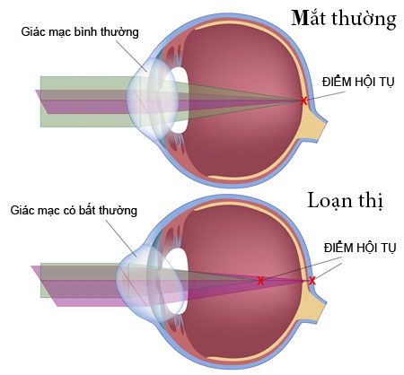 CHĂM SÓC MẮT Ở TRẺ NHỎ, TUỔI ĐI HỌC