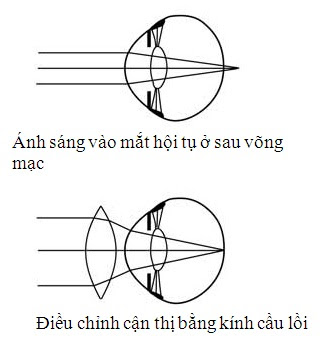 CHĂM SÓC MẮT Ở TRẺ NHỎ, TUỔI ĐI HỌC
